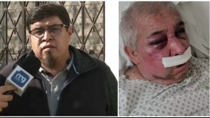 'Me dijo 'me golpearon por un cigarro'': Hijo de conserje de 70 años agredido relata cómo está su padre