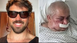 Nuevas acusaciones contra Martín de los Santos, agresor de conserje: Habría golpeado a otro adulto mayor y hostigado a sus vecinos