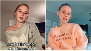 Muere joven influencer que documentó su lucha contra un tumor cerebral: 'Una difícil batalla contra el cáncer'