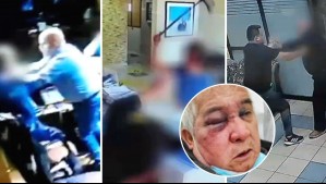 Tras brutal agresión a conserje en Vitacura: Autoridades trabajan en plan contra la violencia en condominios