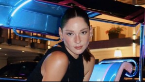 Kel Calderón sufrió doloroso accidente durante sus vacaciones en Vietnam