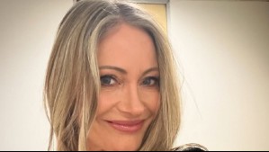 'No sentí nada': El innovador tratamiento de belleza al que se sometió Marcela Vacarezza