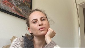 Li Fridman de 'Papá a la deriva' revela que fue diagnosticada con alopecia: 'Uno piensa que vas a quedar pelada'