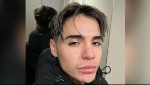 Leo Méndez Jr. sube foto completamente desnudo en medio de su recuperación por compleja cirugía: 'Volveré a ser ese'