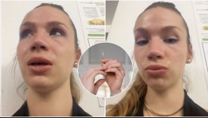 'Empecé a sentir entumecimiento': Joven que fue atacada con inyección en festival de Francia cuenta su terrorífica experiencia