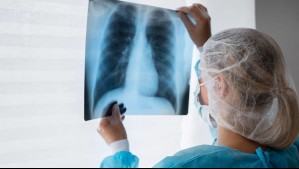 Corte de Concepción ordena a aseguradora pagar cobertura de salud rechazada por supuesta preexistencia