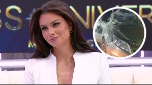 Emilia Dides recordó accidente que sufrió hace dos años: 'Tengo una cicatriz en la mano que no se borra'