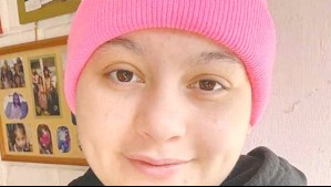 'No me quiero morir': El desgarrador relato de joven limachina que batalla contra agresivo cáncer que no está en el GES