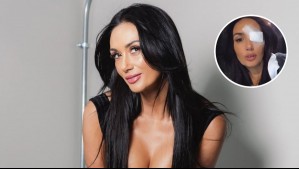 ¿Qué es un chalación?: Este es el problema ocular que llevó a Pamela Díaz a ser intervenida