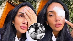 'Esto no se me está pasando': Pamela Díaz sufrió particular y complejo problema en su ojo y tuvo que ser intervenida