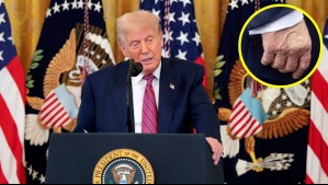 Insuficiencia venosa: ¿Qué es y cuáles son los síntomas de la enfermedad de Donald Trump?