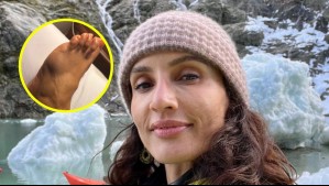 Leonor Varela sufre accidente doméstico que la dejó con una triple fractura de un hueso