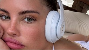 Hijo de Coté López sufrió un doloroso accidente: Influencer compartió imagen desde clínica