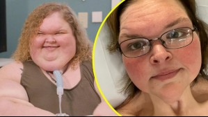 'Trabajé muy duro para lograrlo': Protagonista de 'Kilos Mortales' impacta al mostrarse tras cirugía de extracción de piel