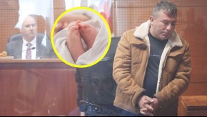 Padrastro de bebé de 9 meses quemado con hervidor queda en prisión preventiva: Lactante sigue grave con 40% del cuerpo afectado