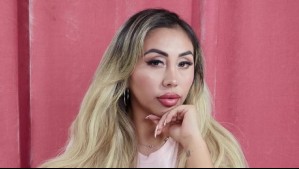 'Este no es el resultado final': Naya Fácil comparte imágenes de procedimiento estético al que se sometió