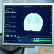 Un neurólogo de la Universidad de Michigan reveló 4 alimentos que podrían dañar seriamente tu cerebro, incluyendo leche cruda, pescado tropical y latas abolladas. Conoce los riesgos.