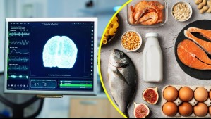 Neurólogo revela 4 alimentos que podrían dañar gravemente tu cerebro y de los que probablemente no sabías