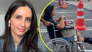 Leonor Varela muestra impactante imagen de su pie tras sufrir triple fractura de hueso: 'Aprendí que son ustedes unos morbosos'