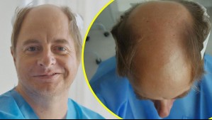 Coke Hevia muestra impactante resultado de tratamiento estético: 'Así es como quería verme'