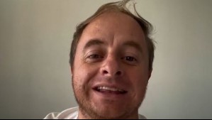 'El cambio ha sido increíble': Jorge 'Coke' Hevia muestra impactante resultado de tratamiento estético