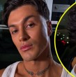 Revisa las declaraciones de Nicolás Solabarrieta, quien reveló que inició un proceso de remoción con láser para eliminar algunos de los tatuajes que se realizó en una zona visible del cuerpo.