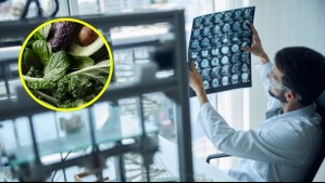 El vegetal de hojas verdes que podría disminuir tu riesgo de demencia: Es muy común en las cocinas chilenas