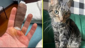 Su gato la rasguñó y terminó con una grave infección en el dedo: Le tuvieron que quitar la uña