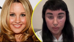 Exestrella juvenil Amanda Bynes sorprende con nueva apariencia tras someterse a tratamiento estético