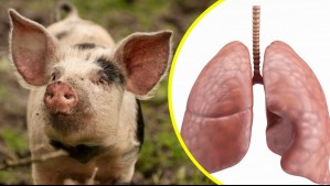 Es el primero en la historia: Trasplantan un pulmón de cerdo a un humano con muerte cerebral
