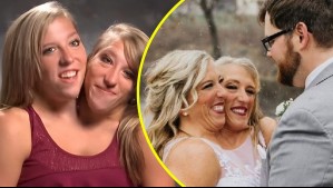 Famosas hermanas siamesas fueron captadas con un bebé y despiertan rumores de maternidad: Una de ellas está casada