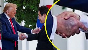 Preocupación por salud de Trump: Tiene 79 años y presenta hematomas en sus manos