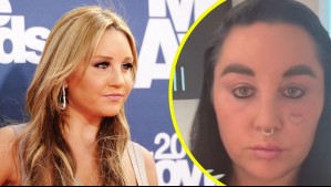 Sorprende con nueva apariencia tras someterse a tratamiento estético: Así luce la exestrella juvenil Amanda Bynes