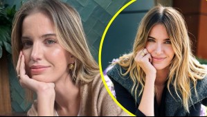 Millaray Viera revela que enfrenta delicado diagnóstico: 'Tengo una enfermedad autoinmune'