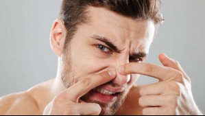 Expertos advierten: Por qué nunca deberías reventarte un grano en el 'triángulo de la muerte'