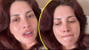 'Me tuvieron que poner una prótesis': Karen Bejarano detalló su estado de salud tras inesperada visita a la clínica