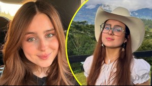 Influencer Roro se operó la nariz: Así luce su antes y después