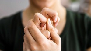 ¿Es malo tronarse los dedos? Estas son las consecuencias que podría traer para tu salud