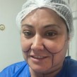A través de su cuenta de Instagram, Denisse Campos mostró cómo se encuentra luego de someterse a varias intervenciones de estética. Revisa más ingresando a la nota.