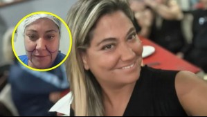 'Estoy en conversaciones con...': Denisse Campos revela los motivos por los que se sometió a procedimientos estéticos