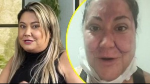 Denisse Campos es criticada por volver al trabajo tras múltiples retoque estéticos: '¿Esto es antes de la operación?'