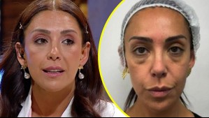 Mariela Sotomayor impacta al mostrar su rostro después de intervención estética: 'Qué heavy el cambio'