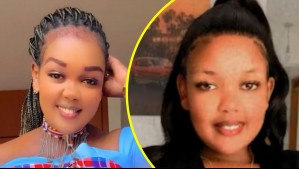 Muere conocida influencer de TikTok a sus 26 años: Sufrió durante días fuertes dolores de cabeza