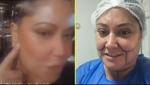 Denisse Campos anunció que se someterá a nuevo procedimiento estético: 'Tienen que rezar por mí'