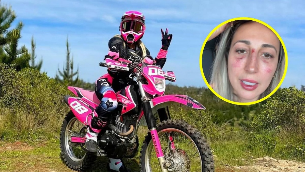 "Pensé que había muerto": Rebeca Naranjo sufre aparatoso accidente y Nano Calderón le pide que venda su moto - Meganoticias