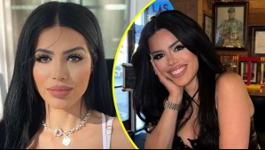 'Sigue siendo un shock mirarme': Influencer brasileña se arrepintió de sus cirugías estéticas