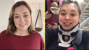 Mujer estuvo a punto de perder la vida al bostezar: 'Me dieron un 50% de posibilidades de sobrevivir'