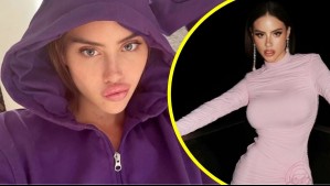 Ignacia Michelson revela cuánto ha gastado en cirugías estéticas: 'No todas las pagué yo'