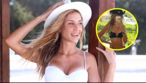 Yuli Cagna debió subir dos kilos para someterse a liposucción: 'Me preguntaron si estaba loca'