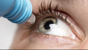 Bono PAD Fonasa: ¿Cuánto cuesta operarse de cataratas?